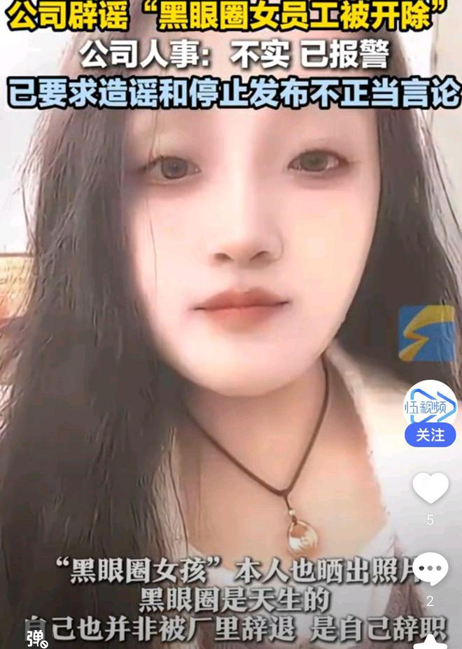 女孩”反转眼睛天生那样未因上热搜被炒j9九游会(中国)网站深圳“黑眼圈(图5)