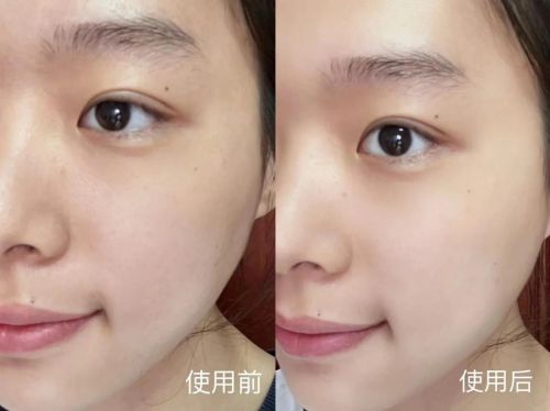 些品牌好？抗老去皱纹护肤品：抗皱紧致！j9九游会真人游戏第一抗衰老护肤品有哪(图7)